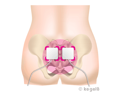 Electrode Pads on the base of your back